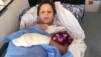 «المصريين يطيبوا لي رجلي ».. رسالة الطفل الفلسطيني عبدالله للسيسي بعد الاستجابة لعلاجه