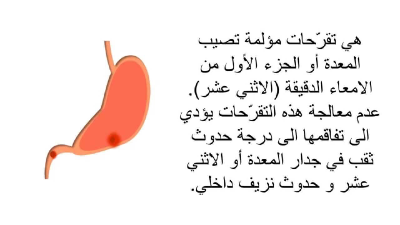 هل قرحة المعدة خطيرة قرحة المعده اعراض قرحة المعده اسباب قرحة المعدة أعراض قرحة المعدة والقولون علاج قرحة المعدة قرحة المعدة اعراض قرحة المعدة 